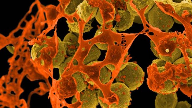 ZIENTZIALARI: Bakterioak (Itziar Alkorta)